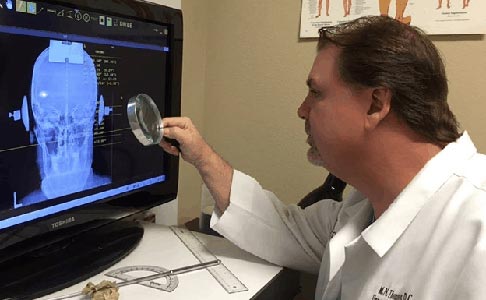 Chiropractor Grapevine TX Michael Thompson Examining X-ray